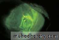 Lectures of Ophthalmology