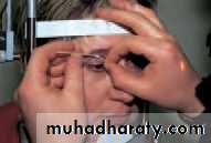 Lectures of Ophthalmology