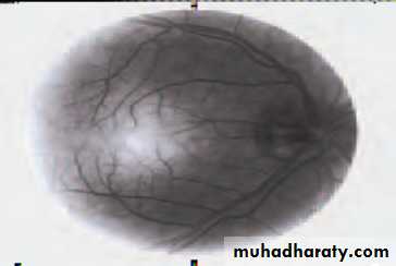 Lectures of Ophthalmology
