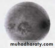 Lectures of Ophthalmology