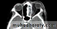 Lectures of Ophthalmology