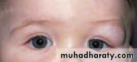Lectures of Ophthalmology