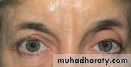 Lectures of Ophthalmology