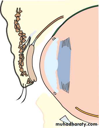 Lectures of Ophthalmology