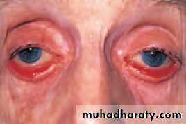 Lectures of Ophthalmology