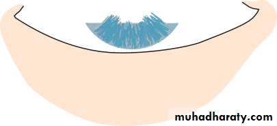 Lectures of Ophthalmology