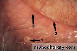Lectures of Ophthalmology