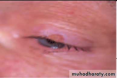Lectures of Ophthalmology