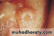 Lectures of Ophthalmology