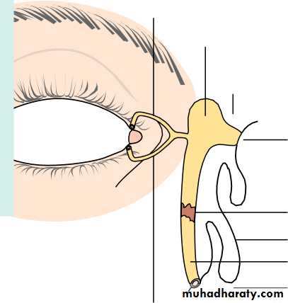 Lectures of Ophthalmology