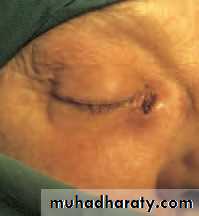Lectures of Ophthalmology