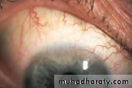 Lectures of Ophthalmology