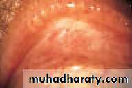 Lectures of Ophthalmology
