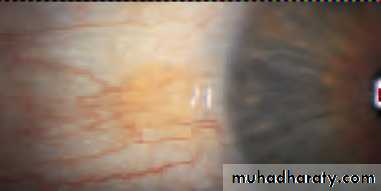 Lectures of Ophthalmology