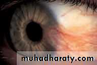 Lectures of Ophthalmology