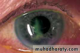 Lectures of Ophthalmology