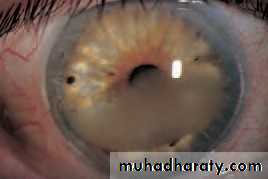 Lectures of Ophthalmology