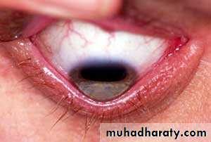 Lectures of Ophthalmology