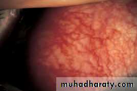 Lectures of Ophthalmology