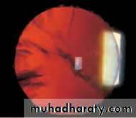 Lectures of Ophthalmology