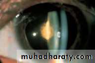 Lectures of Ophthalmology