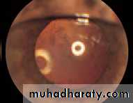 Lectures of Ophthalmology