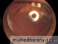 Lectures of Ophthalmology