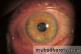 Lectures of Ophthalmology