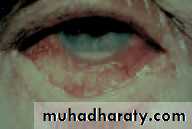 Lectures of Ophthalmology