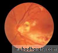 Lectures of Ophthalmology