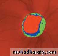 Lectures of Ophthalmology