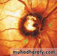 Lectures of Ophthalmology