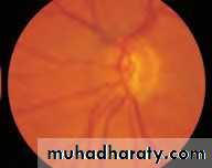 Lectures of Ophthalmology