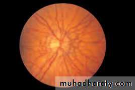 Lectures of Ophthalmology