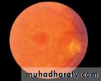 Lectures of Ophthalmology