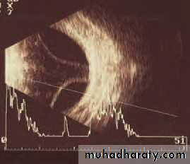 Lectures of Ophthalmology