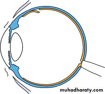 Lectures of Ophthalmology