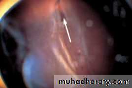 Lectures of Ophthalmology
