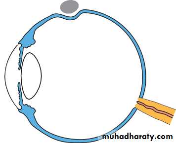 Lectures of Ophthalmology