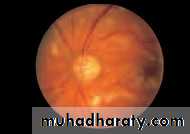 Lectures of Ophthalmology