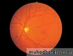 Lectures of Ophthalmology