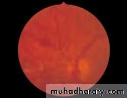Lectures of Ophthalmology