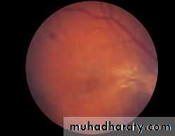 Lectures of Ophthalmology