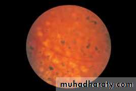 Lectures of Ophthalmology