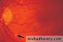 Lectures of Ophthalmology