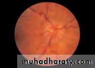 Lectures of Ophthalmology