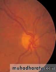 Lectures of Ophthalmology