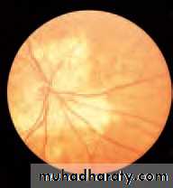 Lectures of Ophthalmology