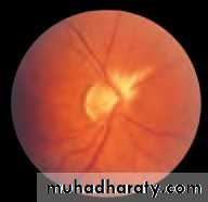 Lectures of Ophthalmology