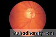 Lectures of Ophthalmology